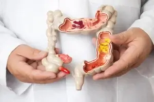 FDA aprova combinação de nivolumabe e ipilimumabe para câncer colorretal avançado