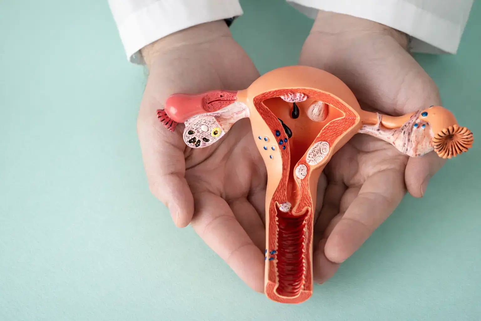 Anvisa aprova Elahere para câncer de ovário resistente à quimioterapia