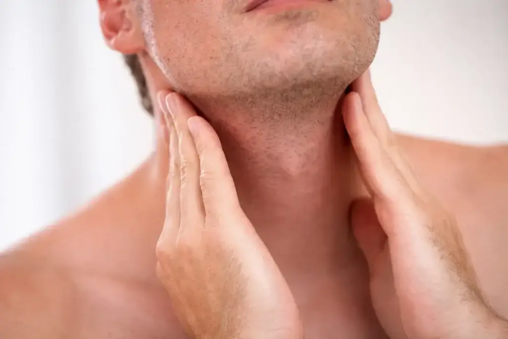 Brentuximab vedotin amplia perspectivas no tratamento do linfoma de Hodgkin