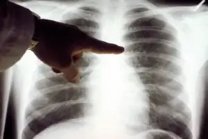 FDA Aprova primeiro medicamento contra o câncer baseado em pesquisa do Broad Institute